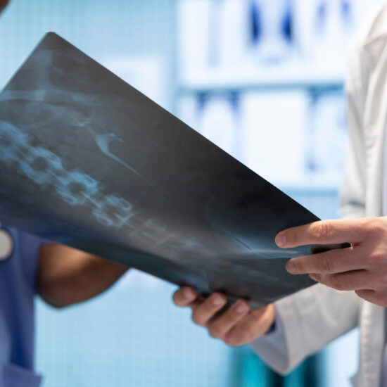Clinicians examining a spinal X-ray together